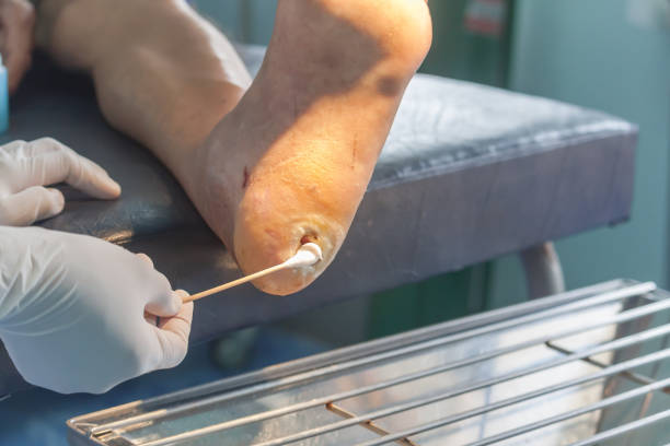 Best Diabetic Foot Surgeon & Ulcer Treatment in Navi Mumbai